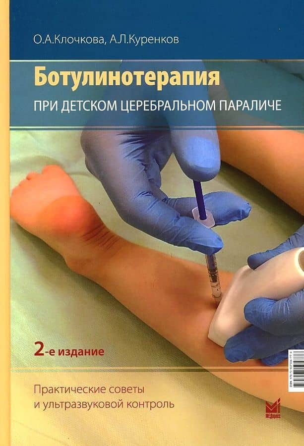 Ботулинотерапия при Детском Церебральном Параличе. Практические советы и УЗИ-контроль