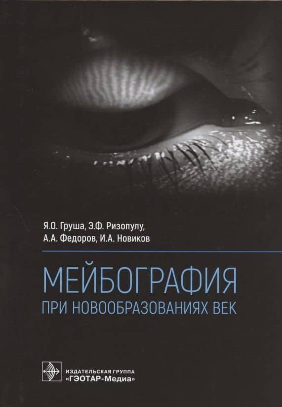 Мейбография при новообразованиях век — Элефтерия Фирузовна Ризопулу