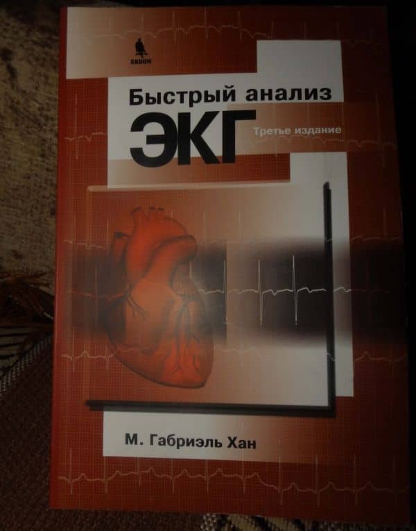 Быстрый анализ ЭКГ — Габриэль М. Хан (3)