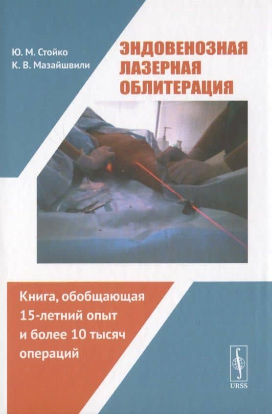 Эндовенозная лазерная облитерация