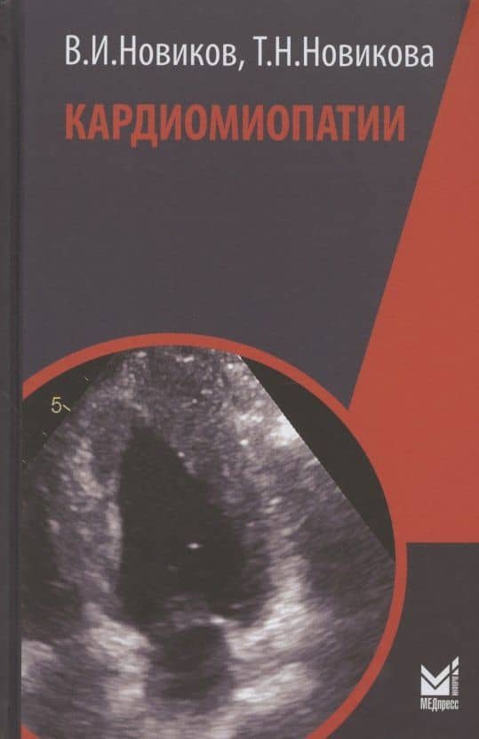 Кардиомиопатии
