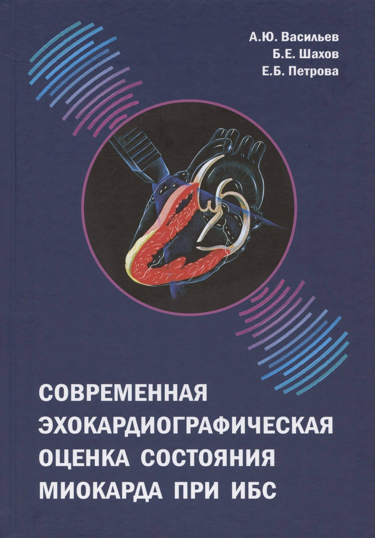 Современная эхокардиографическая оценка состояния миокарда при ИБС — Борис Евгеньевич Шахов