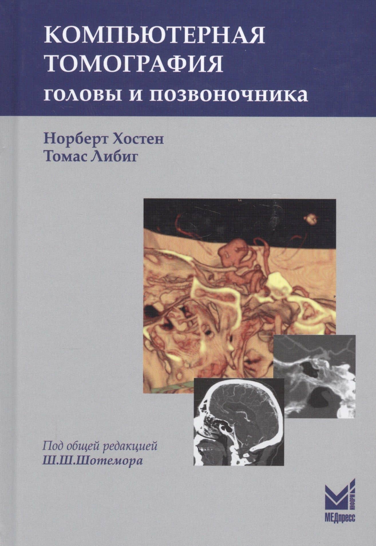 Компьютерная томография головы и позвоночника — Норберт Хостен