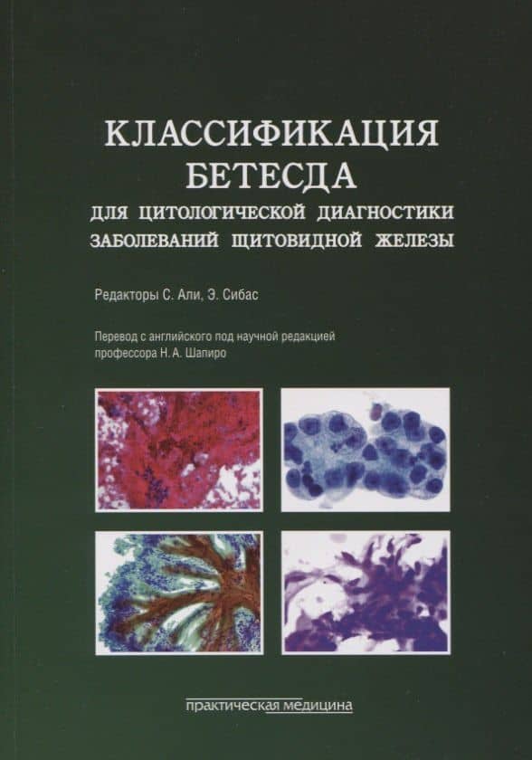 Классификация Бетесда для цитологической диагностики заболеваний щитовидной железы. Терминология, критерии и пояснения